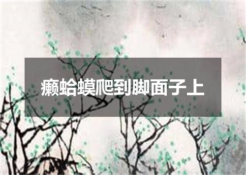 癞蛤蟆爬到脚面子上